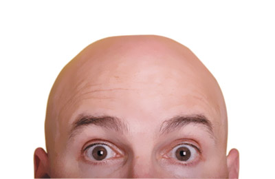 کچل
