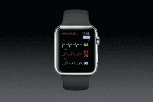 اندازه‌گیری سرعت ضربان قلب جنین با ساعت مچی اپل
