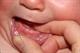 مشکلاتی در رابطه با رشد دندان در سنین پایین